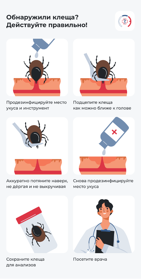 Алгоритм действий