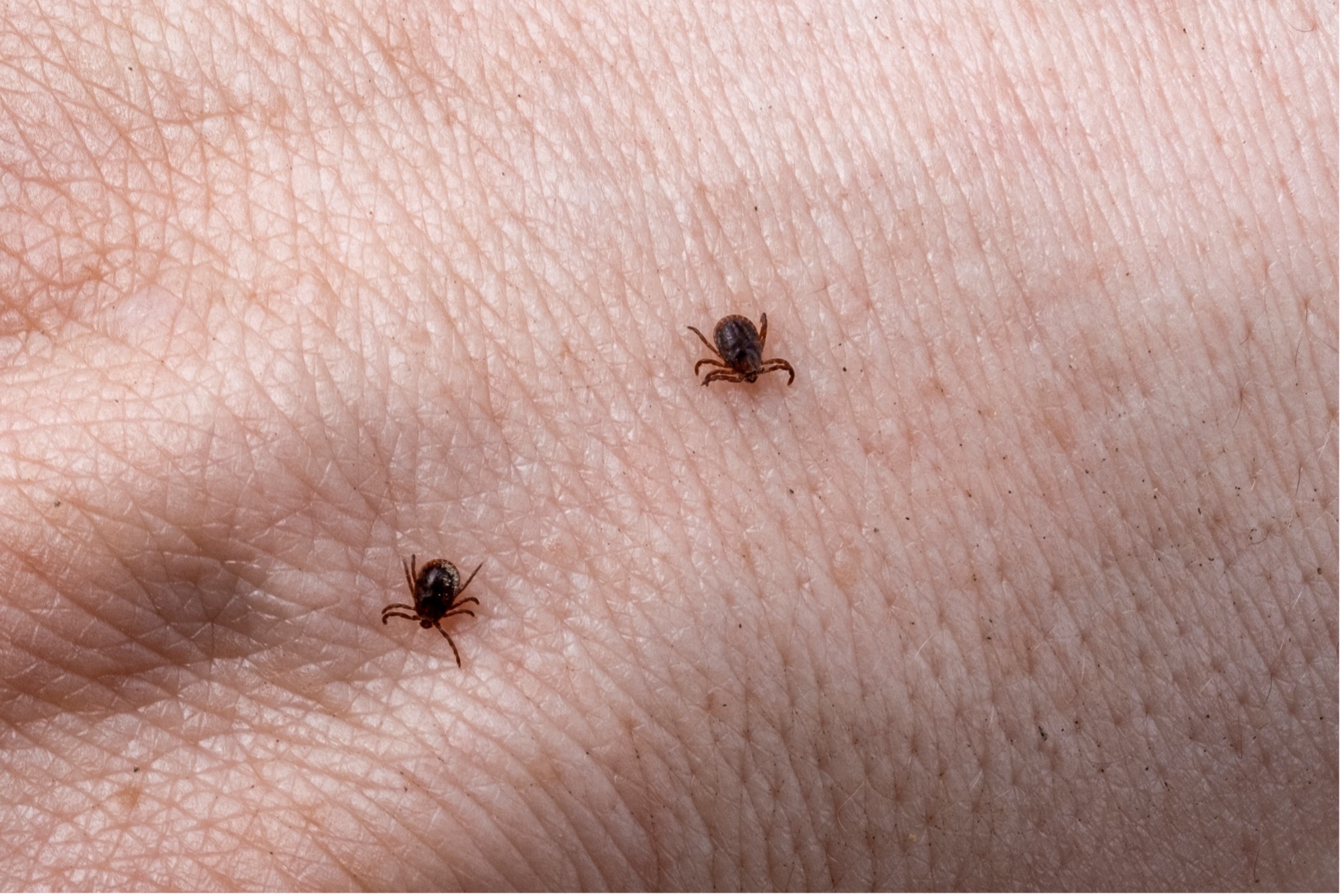 Осмотр после прогулки